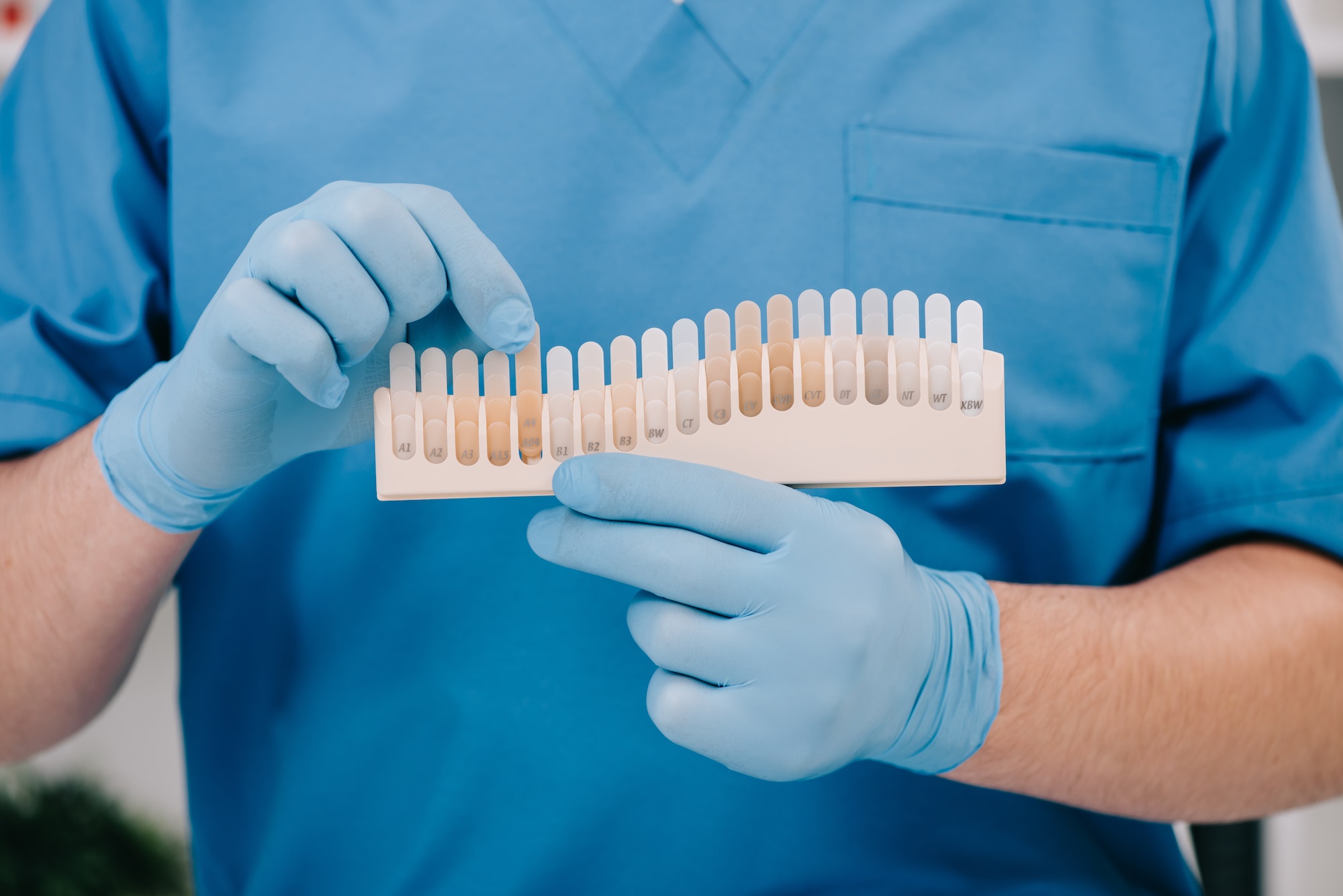 cropped view of dentist holding teeth color palette in clinic, teeth whitening concept